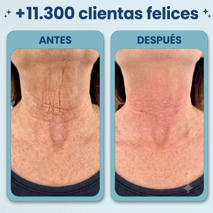 Vital Mask — Tu ritual anti-edad para el cuello